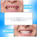 Carillas Dentales - HappySmile  🦷