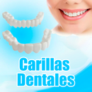 Carillas Dentales - HappySmile  🦷